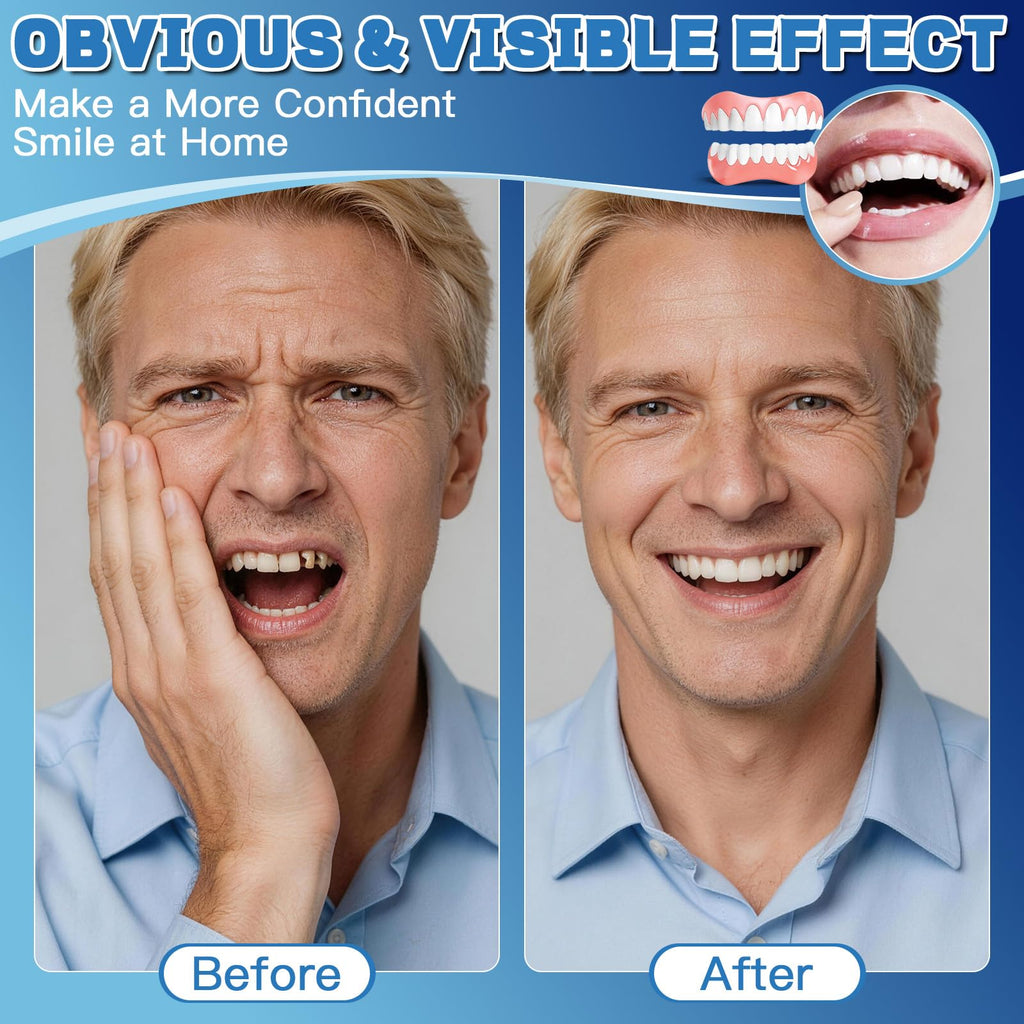 Moldable False Teeth Dentures Set with Dental Adhesive Beads J58907